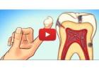 Floss Regularly to Prevent Gum Disease and Improve Oral Health