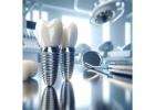 Siiodent Implants: Your Trusted Source for Wholesale Dental Implants