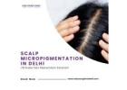 Scalp Micropigmentation Treatment in Delhi