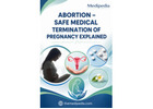 Abortion – Safe Medical Termination of Pregnancy Explained