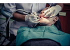 Top Emergency Wisdom Teeth Removal Dental Care