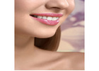 Transform your smile and appeal with steadfast Cosmetic dentist in Tijuana