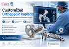 Customized Orthopedic Implants for Advanced Surgical Precision