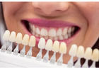 Complete Fontana Dental Care with Same-Day Appointments