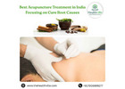 Best Acupuncture Treatment in India Focusing on Cure Root Causes