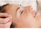 Workplace Wellness Services NYC | Acupuncture for Corporate Events