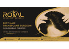 Best Hair Transplant Surgeon in Islamabad