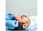 Best Chemical Peel Treatment in Bengaluru