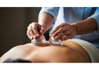 Cupping Therapy NYC | Expert Cupping Services in New York City