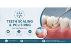 Teeth Scaling and Polishing in Islamabad
