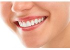 Restorative Dentist Burton – Advanced Dental Care for a Healthier Smile