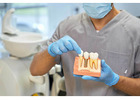 Get that Ideal Smile Makeover from the Best Tijuana Dentist