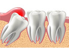 Looking For Teeth Dentist Melbourne for Professional Dental ?