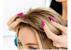 Expert Hair Loss Solutions Dallas