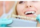 Brighten Your Smile with Cosmetic Dentistry at London Road Dental